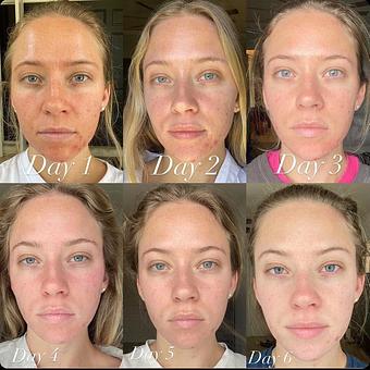 Product - Somatic Massage Therapy, P.C in Floral Park - Floral Park, NY Massage Therapy