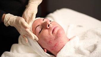 Product: Deep Pore Facial - Somatic Massage Therapy, P.C in Floral Park - Floral Park, NY Massage Therapy