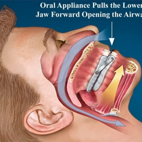 Our Services - Head Pain Institute - Photo (36825)
