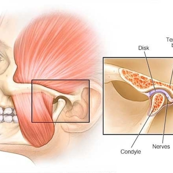Our Services - Head Pain Institute - Photo (36826)