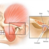 Our Services - Head Pain Institute - Photo (36826)