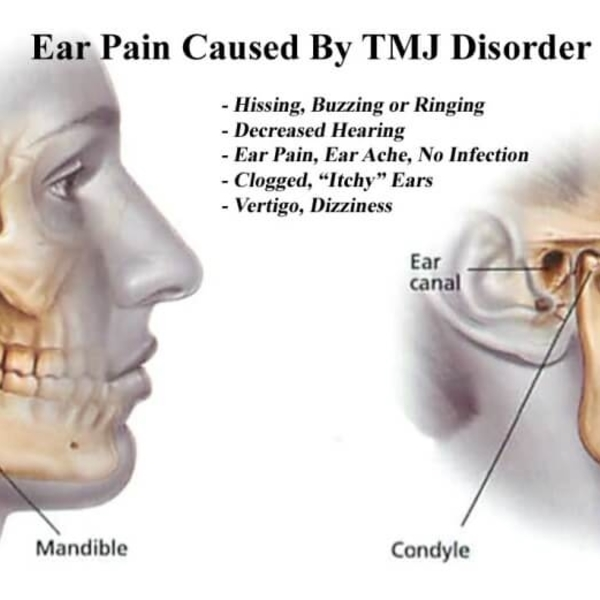 Our Services - Head Pain Institute - Photo (36828)