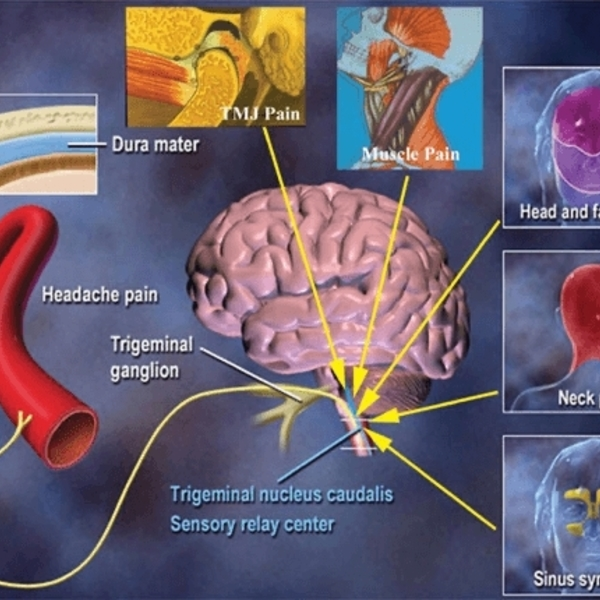 Our Services - Head Pain Institute - Photo (36831)