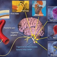 Our Services - Head Pain Institute - Photo (36831)