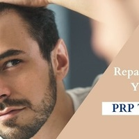 PRP hair transplant therapy
