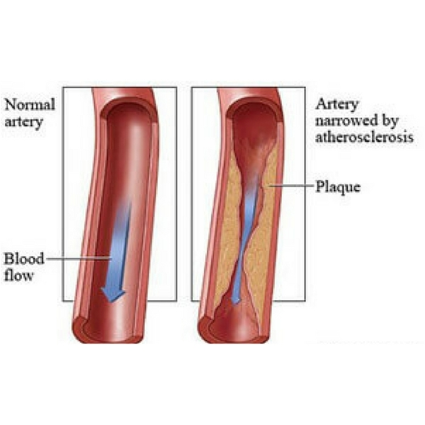 Portfolio - USA Vascular Centers - Photo (45099)
