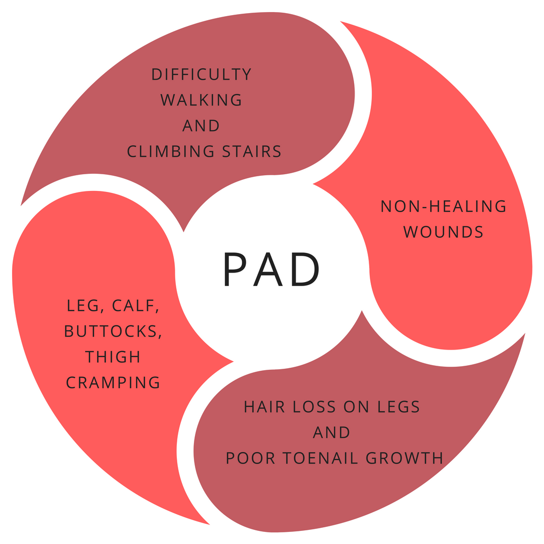 PAD Symptoms - Portfolio -  USA Vascular Centers