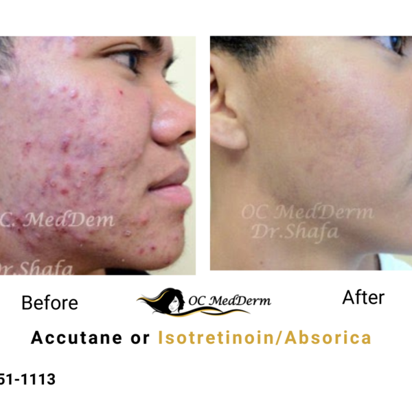 Dermatology Before and After - Oc Medderm - Photo (54689)