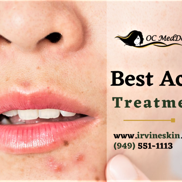 Dermatology Before and After - Oc Medderm - Photo (54695)