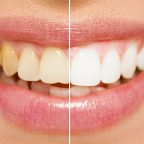 Photos of Our Business - Champlain Smiles - Photo (75082)