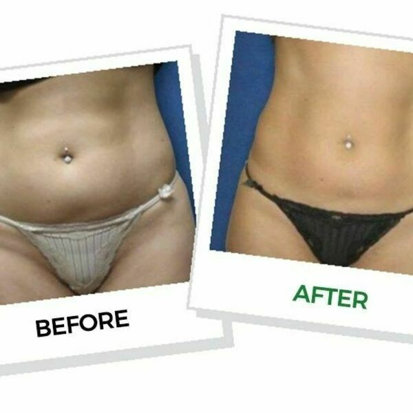 Photos of Our Business - B Live Studios - Beauty and Body Sculpting - Photo (98052)