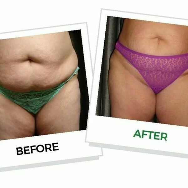 Photos of Our Business - B Live Studios - Beauty and Body Sculpting - Photo (98053)