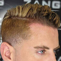 Photos of Our Business - Zang SMP - Scalp Micropigmentation Orange County - Photo (185865)