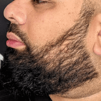 Photos of Our Business - Zang SMP - Scalp Micropigmentation Orange County - Photo (185867)