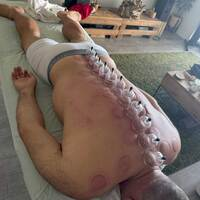 Chinese Medicine Acupuncture in Miami Beach FL - Photos of Our Business -  Organic Palms Massage & Reiki