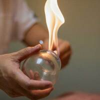 Miami Beach Cupping Therapy - Chinese Medicine -  Organic Palms Massage & Reiki