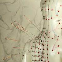Chinese Medicine and Acupuncture in Miami Beach - Chinese Medicine -  Organic Palms Massage & Reiki
