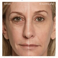 Photos of Our Business - Medspa810 Burlington - Photo (244594)