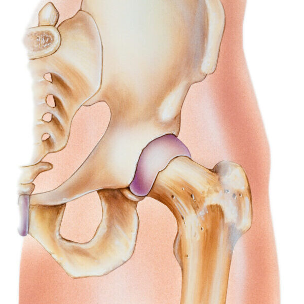 Photos of Our Business - Shore Hip & Joint Brett Shore, MD Hip Surgeon - Photo (280065)